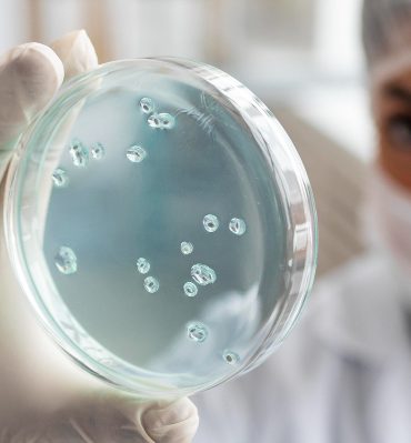 Kök Hücre (Eksozom) Tedavisi